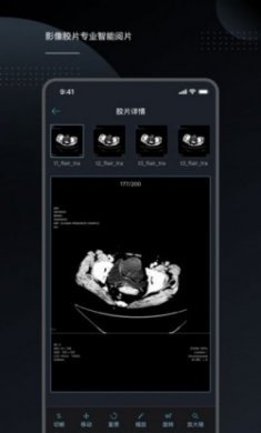 云胶片影像报告app安卓版